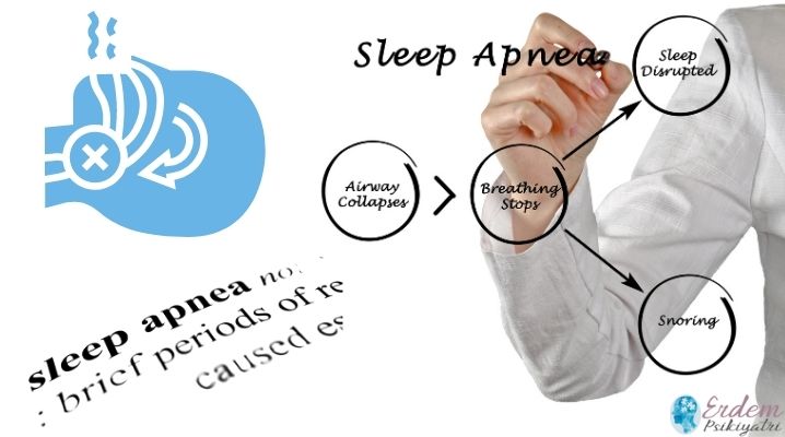 Uyku apnesi yazısı ve bir hekim eli ile işaretleri vardır